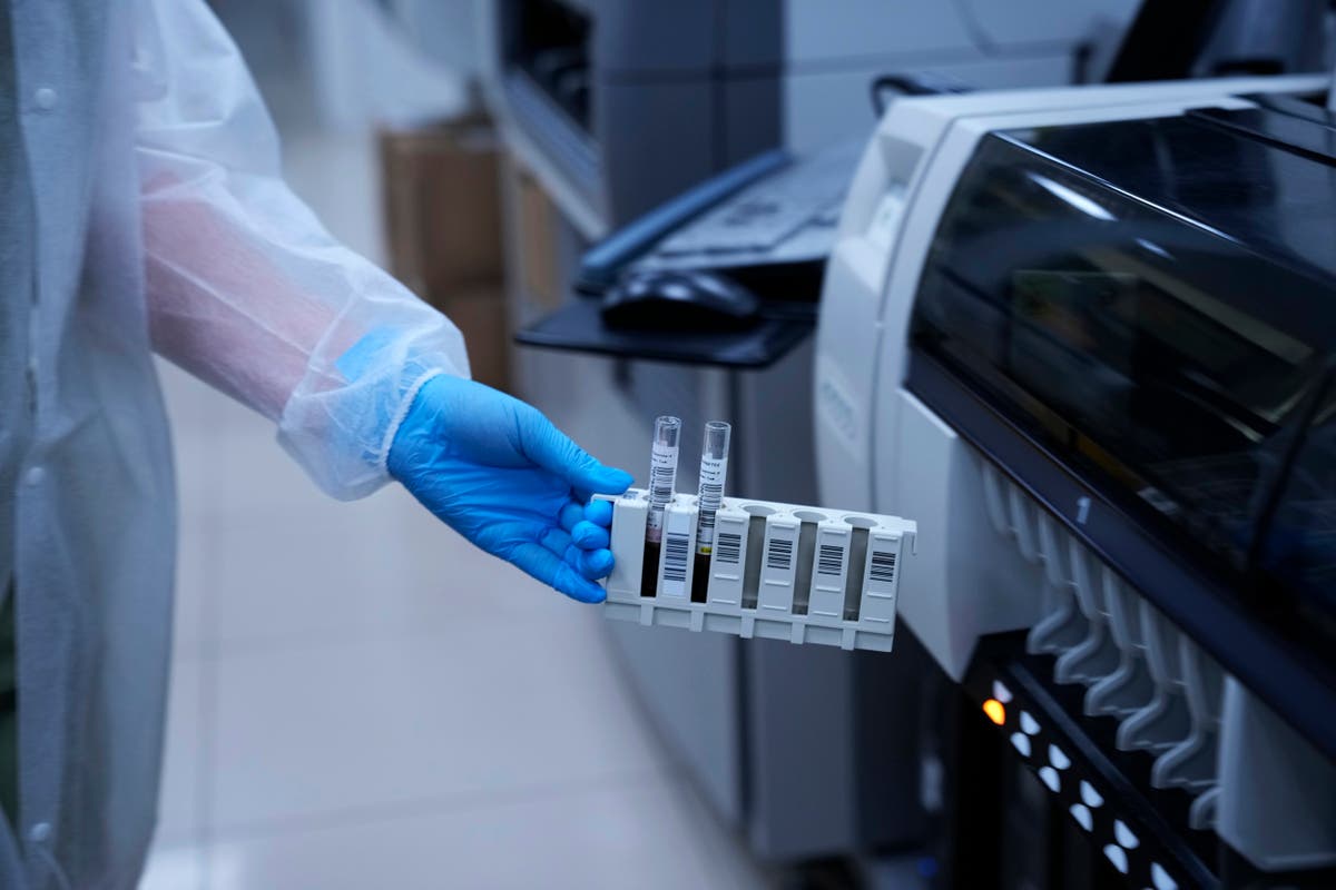 Antibody tests for COVID-19 remain popular in Russia