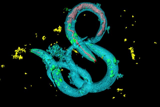 Caenorhabditis elegans (en la foto) alimenta a su descendencia con un líquido que destruye sus órganos internos
