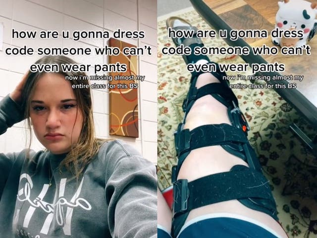 <p>Teenager in leg brace calls out school dress code </p>