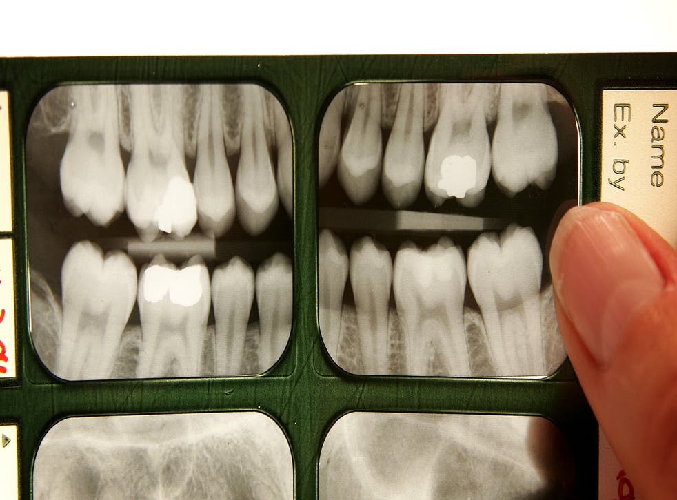 Las radiografías dentales se muestran en una caja de luz