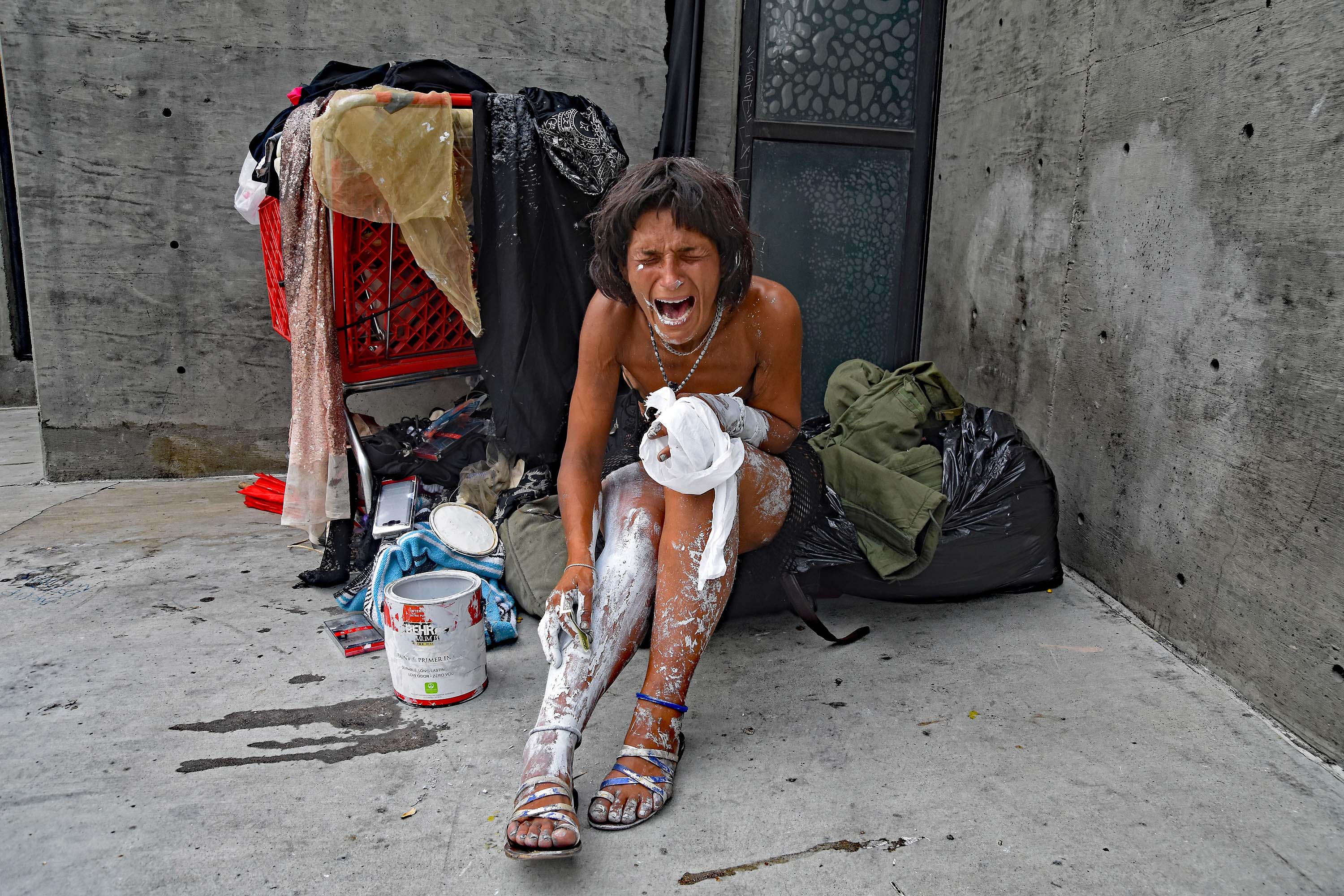 Anna, a homeless woman originally form Afghanistan, is a severe crystal meth addict. She has smeared her legs and arms with white wall paint