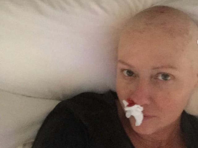 <p>Shannen Doherty shares candid pictures of her cancer experiences</p>