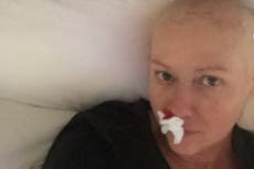 Shannen Doherty shares candid photos to show the ‘truth’ of cancer