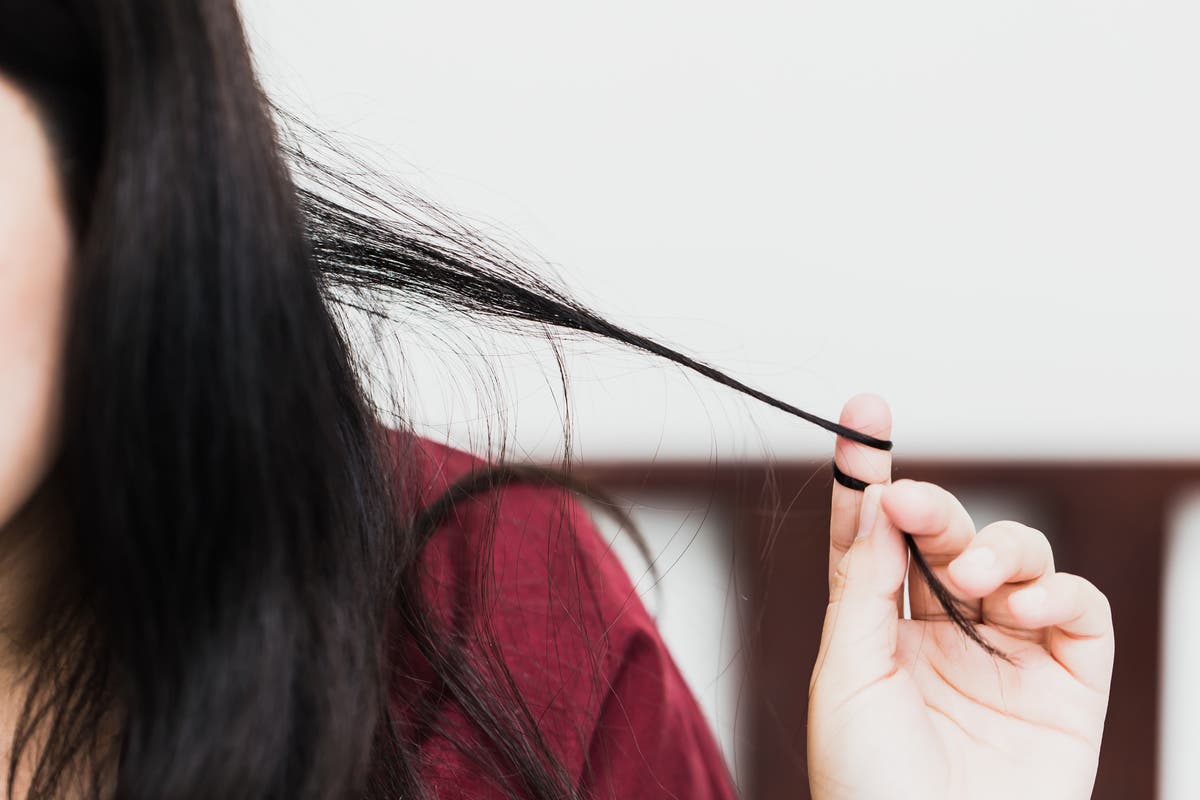 I pluck the hair from my scalp like a trophy': Living with trichotillomania  | The Independent