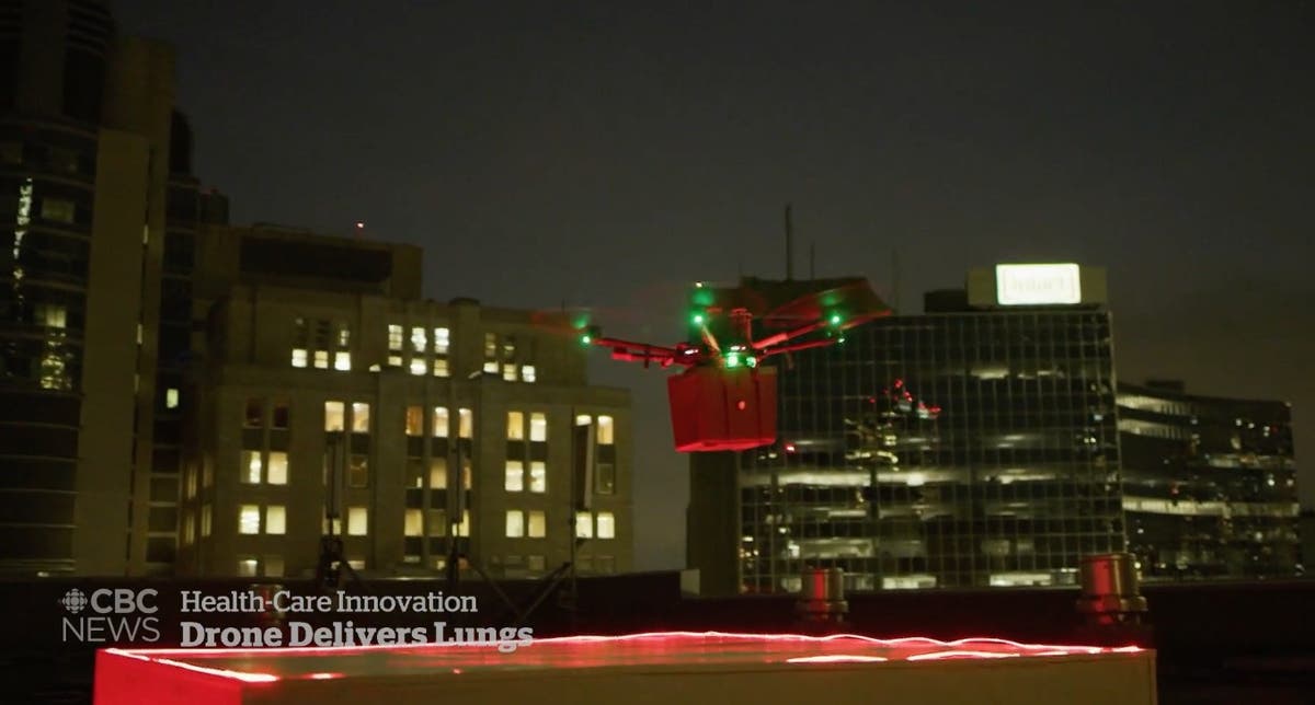 Hospital carries out world&rsquo;s first drone-delivered lung transplant