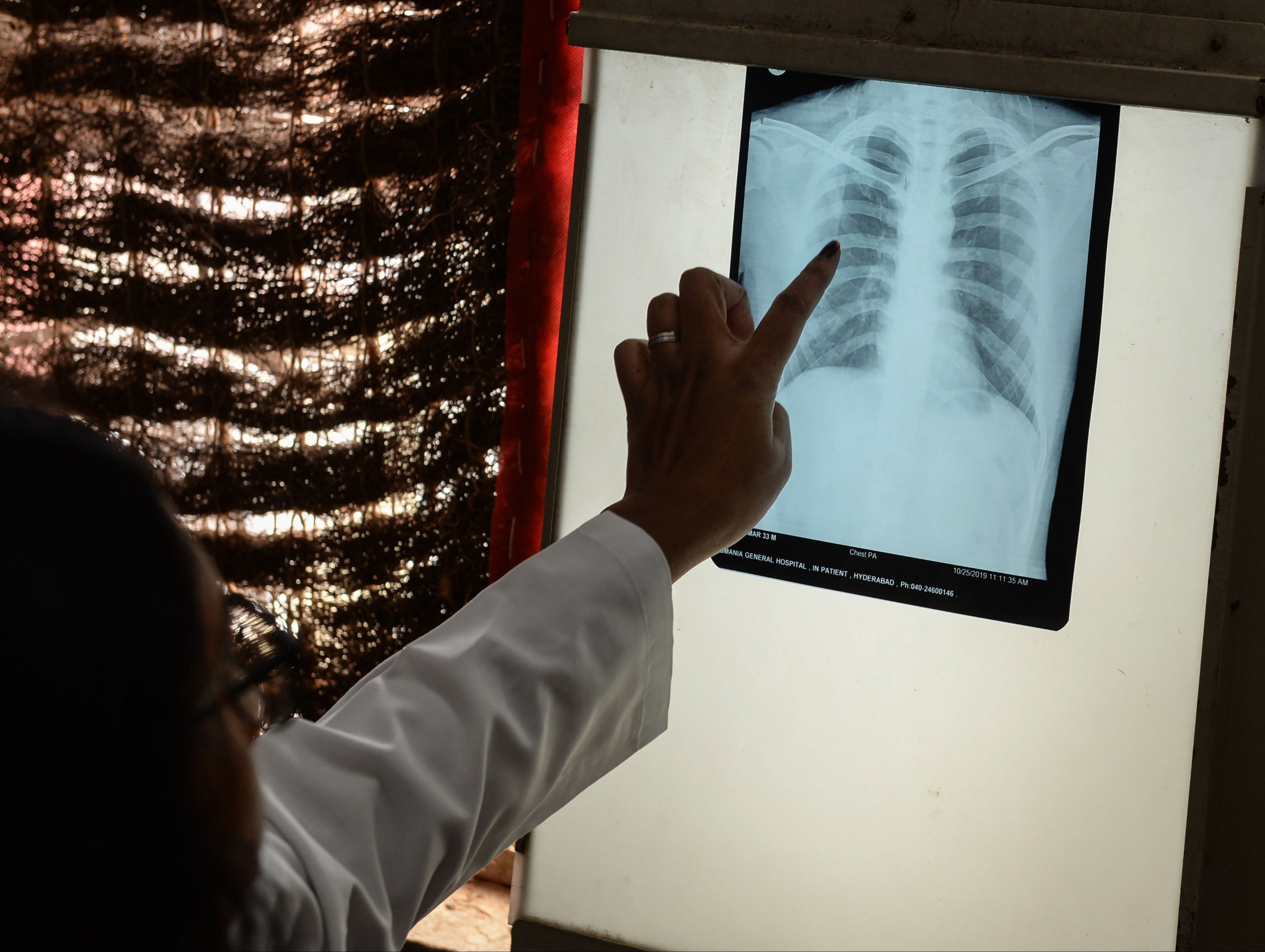Some 1.5 million people died from TB in 2020, up from 1.4 million in the previous year