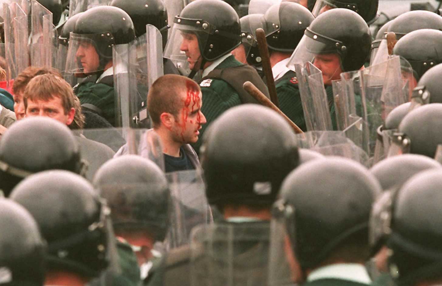 Blood flows from a man's head during a protest against marchers in Drumcree