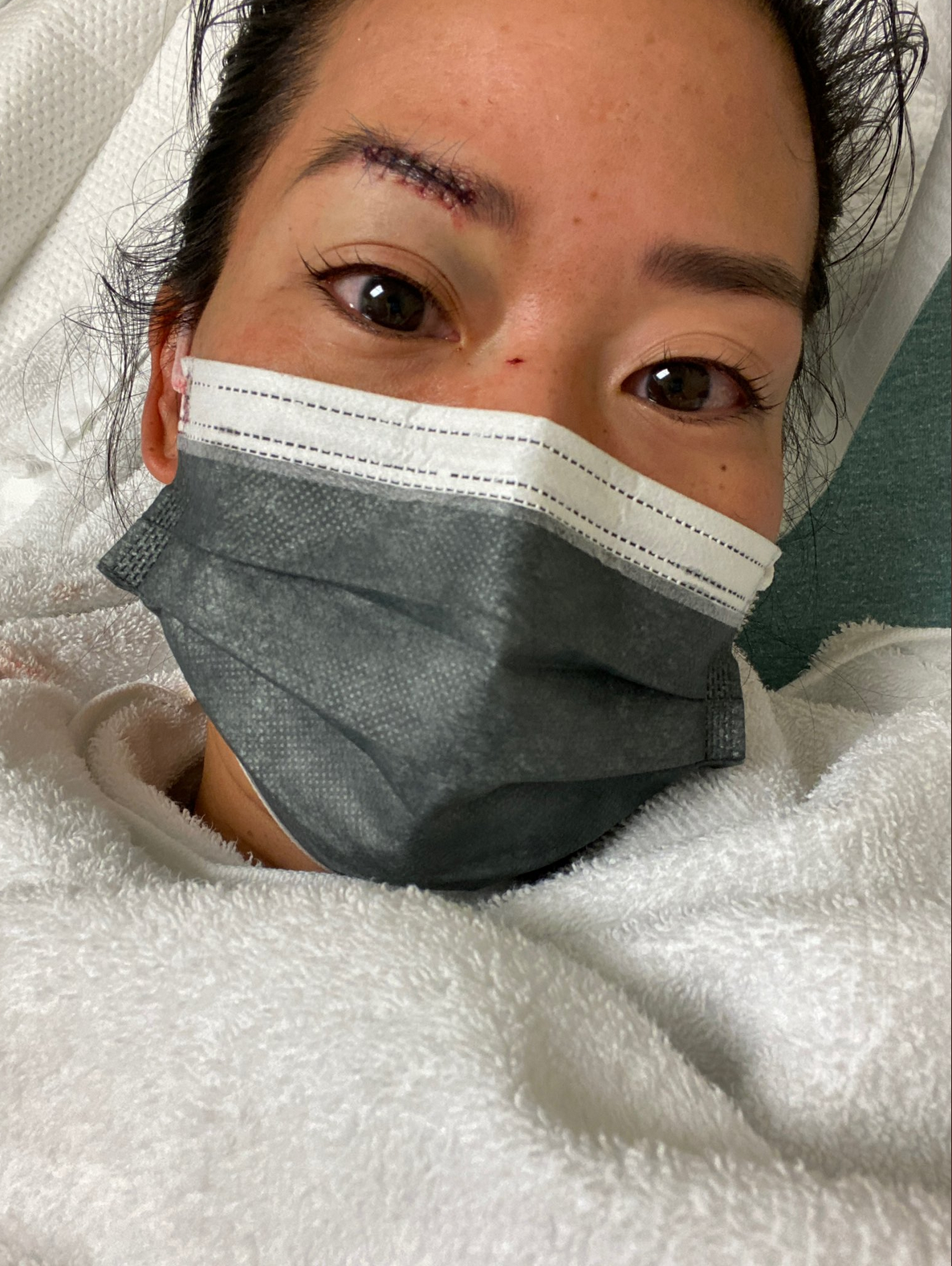Ms Yi’s parents live in Taiwan, and said it was a ‘lonely time’ being in hospital