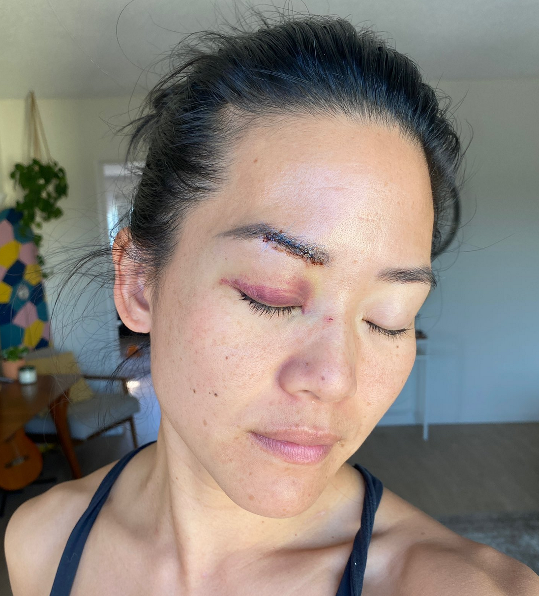 Michelle Yi says she was beaten over the head with a metal bar
