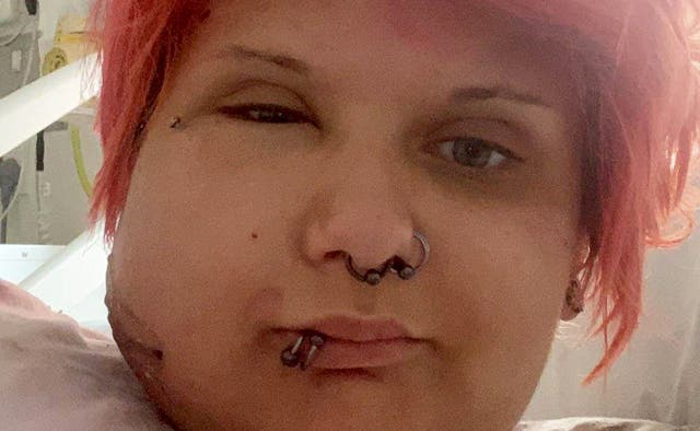 <p>Ms Sabine ended up in hospital </p>