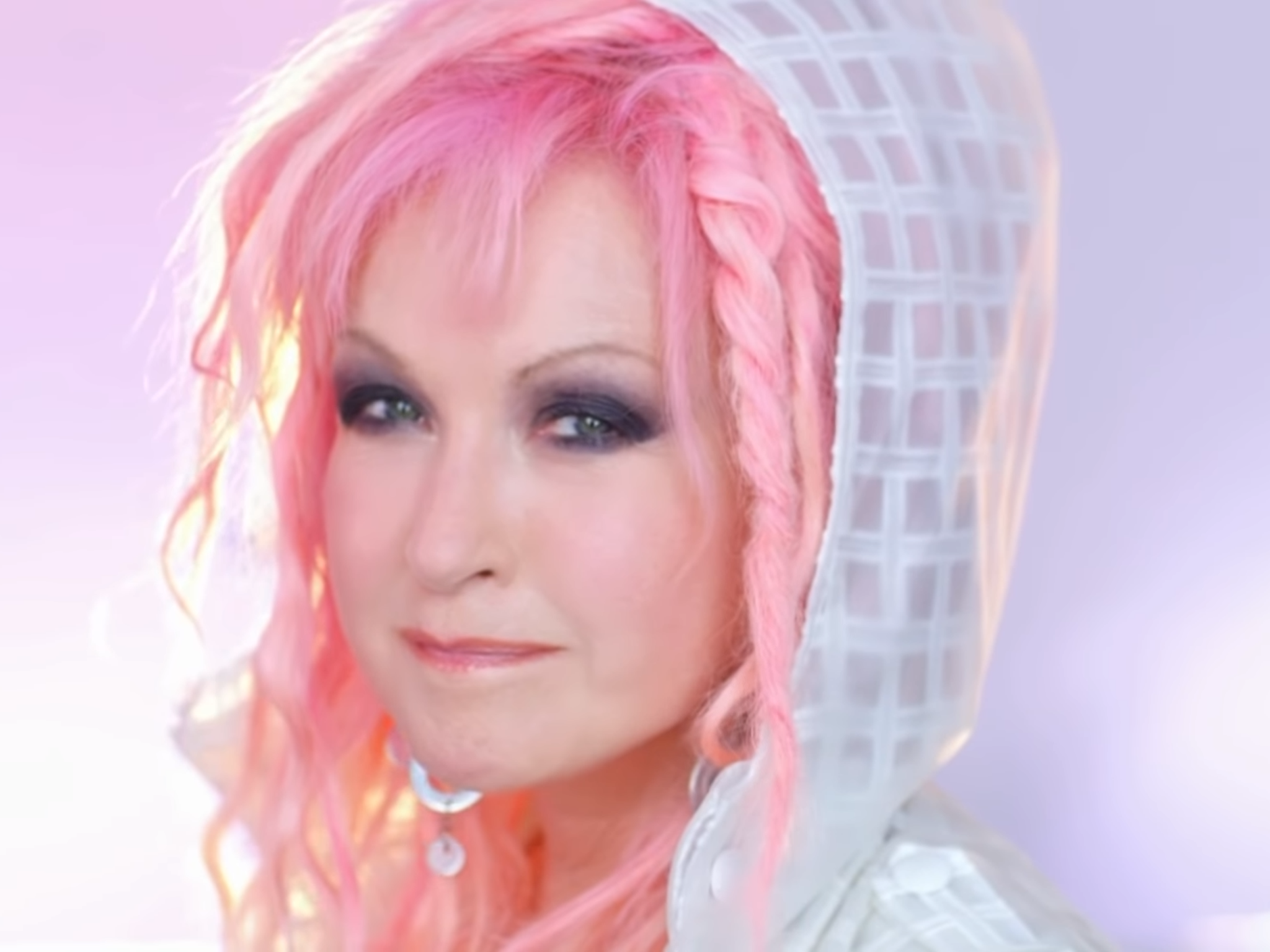 Cyndi Lauper, lazy socialism, psoriasis and me | The Independent