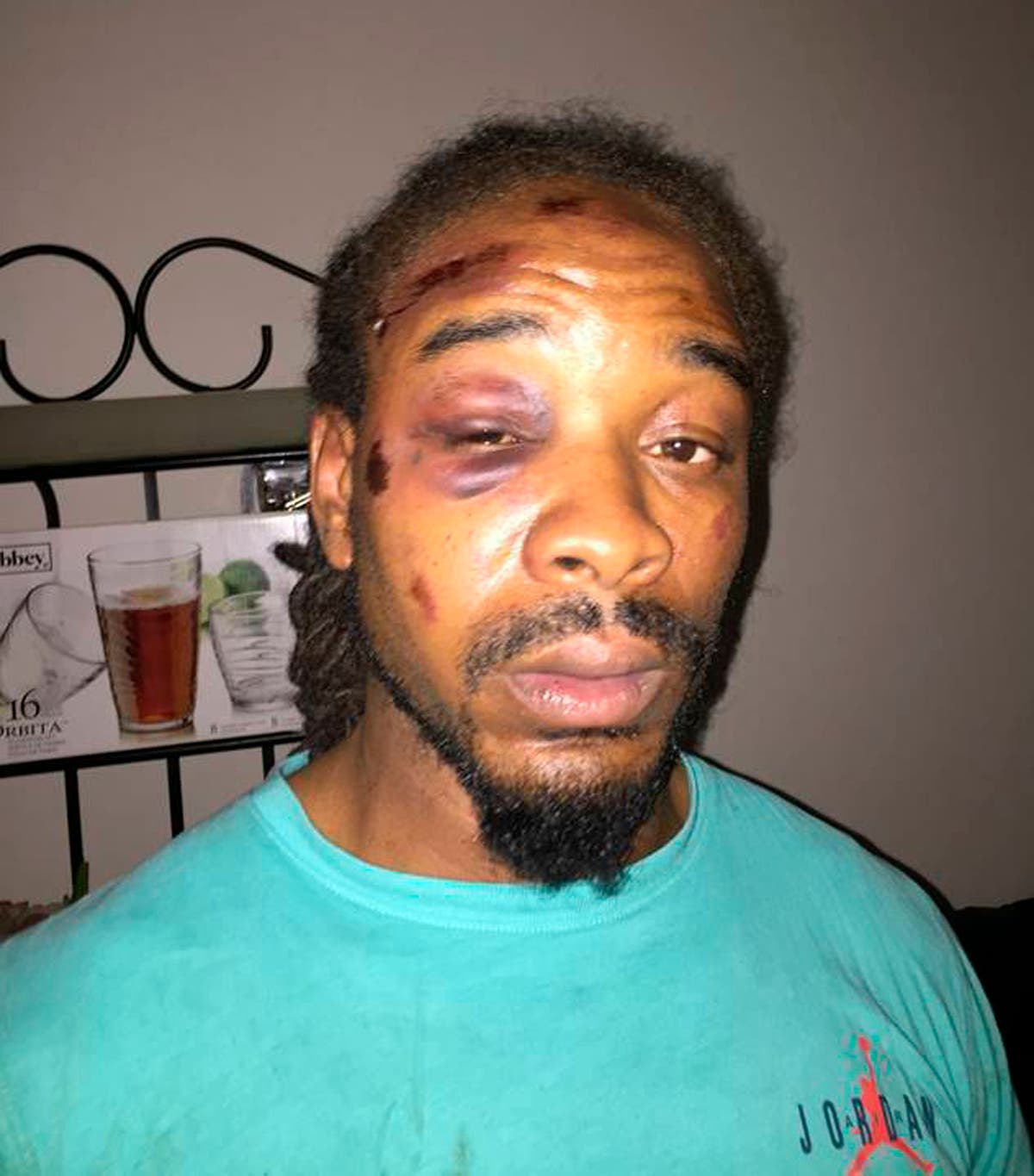 Lawsuit: Suburban St. Louis police officers beat Black man