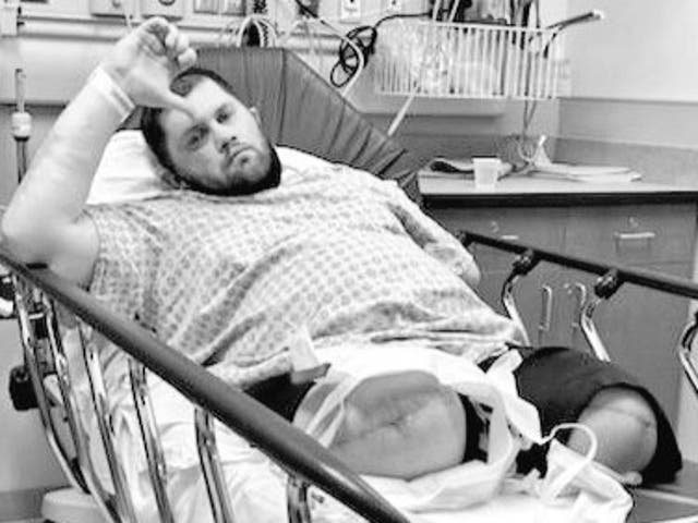 <p>Former wrestler Jimmy Rave had both of his legs amputated after an MRSA infection</p>