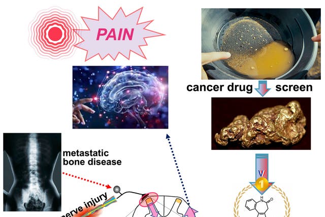 <p>A drug developed over 20 years ago to treat cancer could help patients living with crippling pain, new research suggests </p>