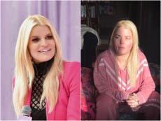 Jessica Simpson praised for sharing ‘unrecognisable’ photo from height of addiction