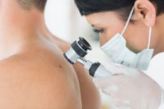 How a skin cancer diagnosis led to The Mole Clinic