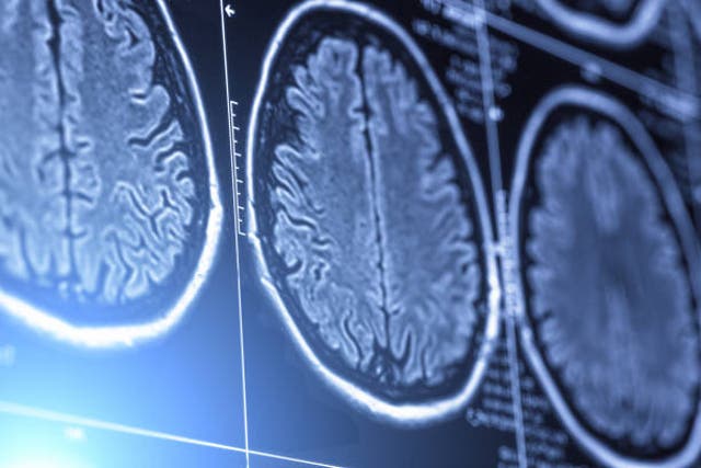 <p>Current theories assume our brain gets smaller as we grow older</p>