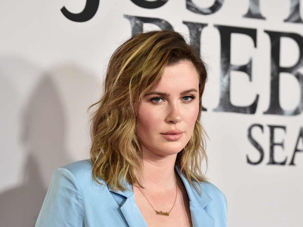 Ireland Baldwin says she wouldn’t be a model without famous parents