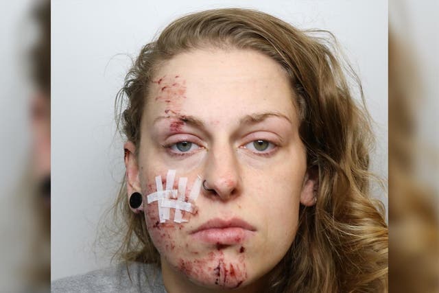 <p>Karolina Serafin suffered minor facial injuries in the crash which left three pedestrians severely hurt</p>