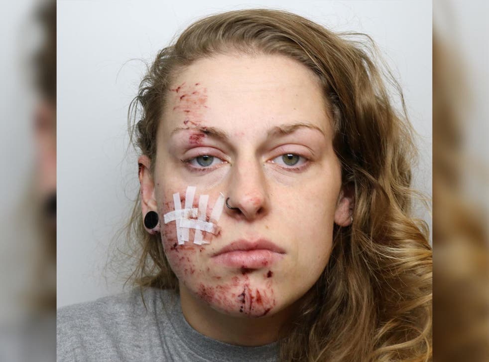 <p>Karolina Serafin suffered minor facial injuries in the crash which left three pedestrians severely hurt</p>