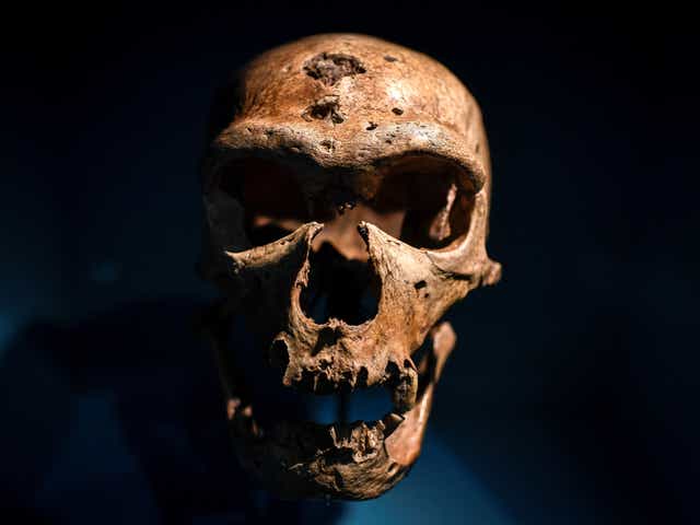 <p>Neanderthals had a thickened brow ridge and large nose cavities compared to humans </p>
