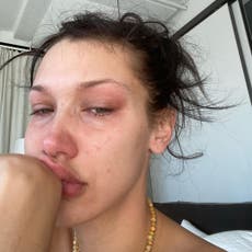 Bella Hadid posts crying selfies to highlight battle with mental health: ‘This is my every day’
