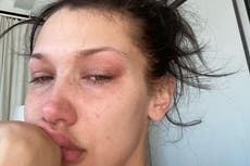 Bella Hadid posts crying selfies to highlight battle with mental health: ‘This is my every day’