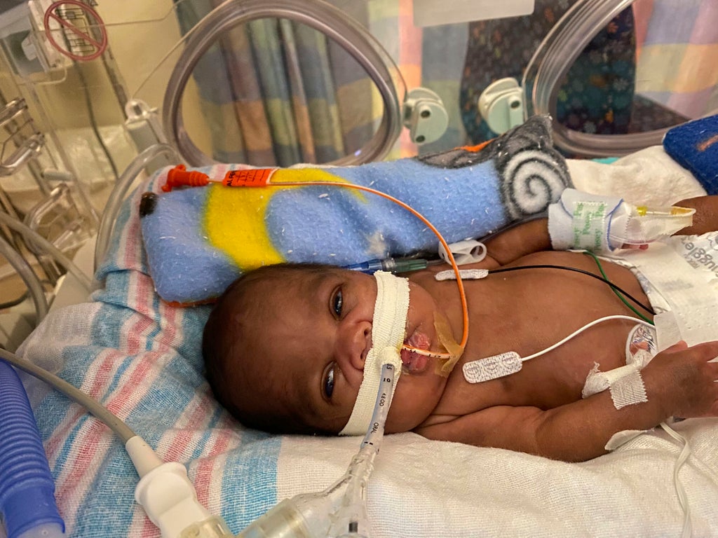 Alabama boy born 19 weeks early sets world record for most premature baby to survive