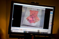 Jurors see graphic photos of Ahmaud Arbery’s gaping gunshot wounds and white t-shirt stained red with blood