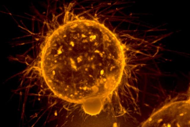 <p>Breast tumor cell in a free-floating environment</p>