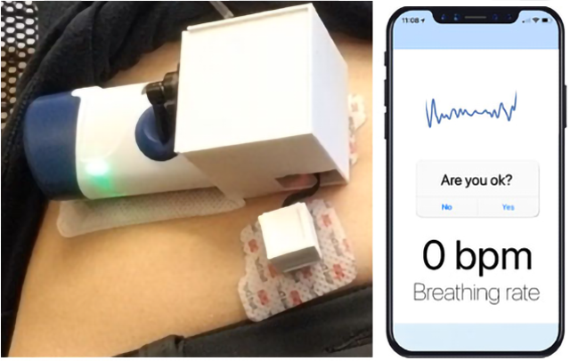 <p>Prototype device includes sensors and an existing injector, shown on an abdomen, and communicated to a smartphone app</p>
