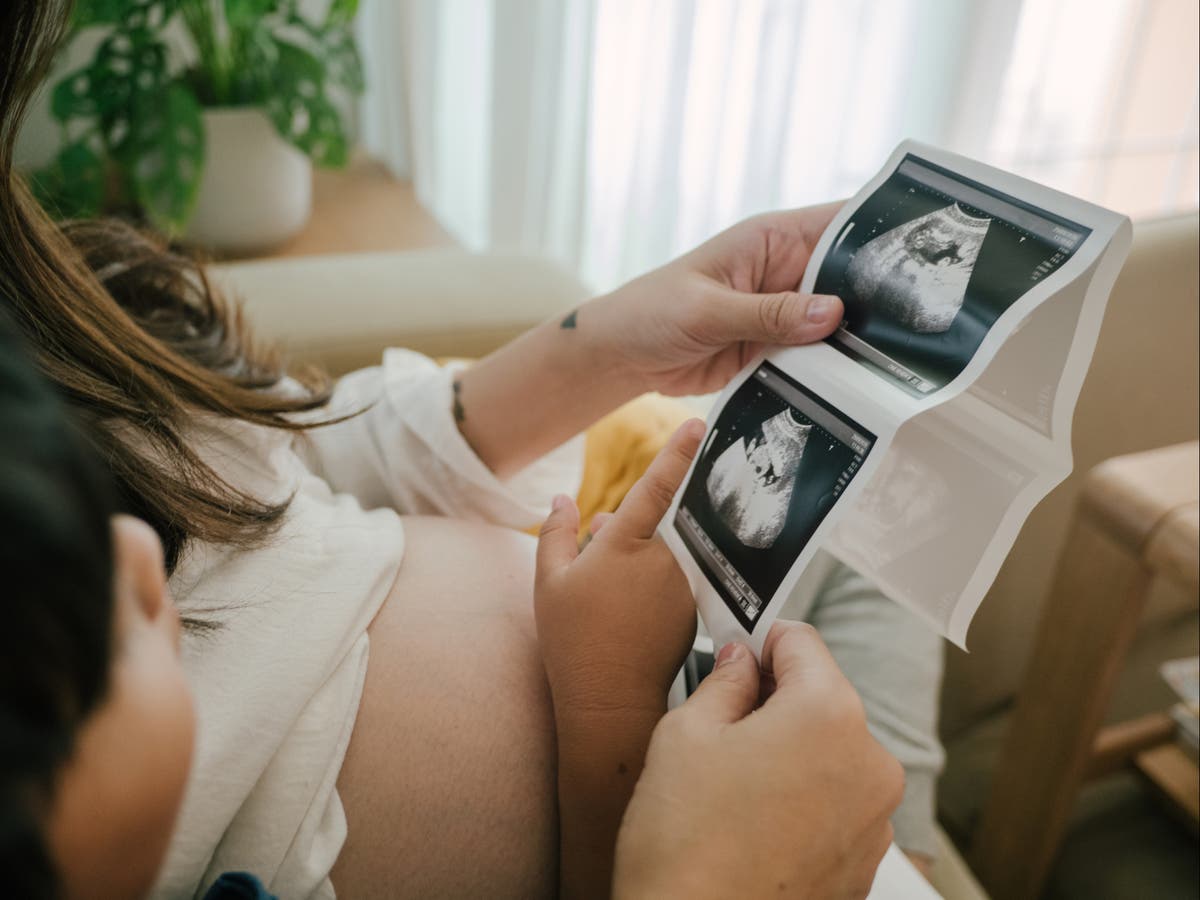 Taking progesterone could prevent ‘thousands’ of miscarriages, charity says Taking progesterone could prevent ‘thousands’ of miscarriages, charity says