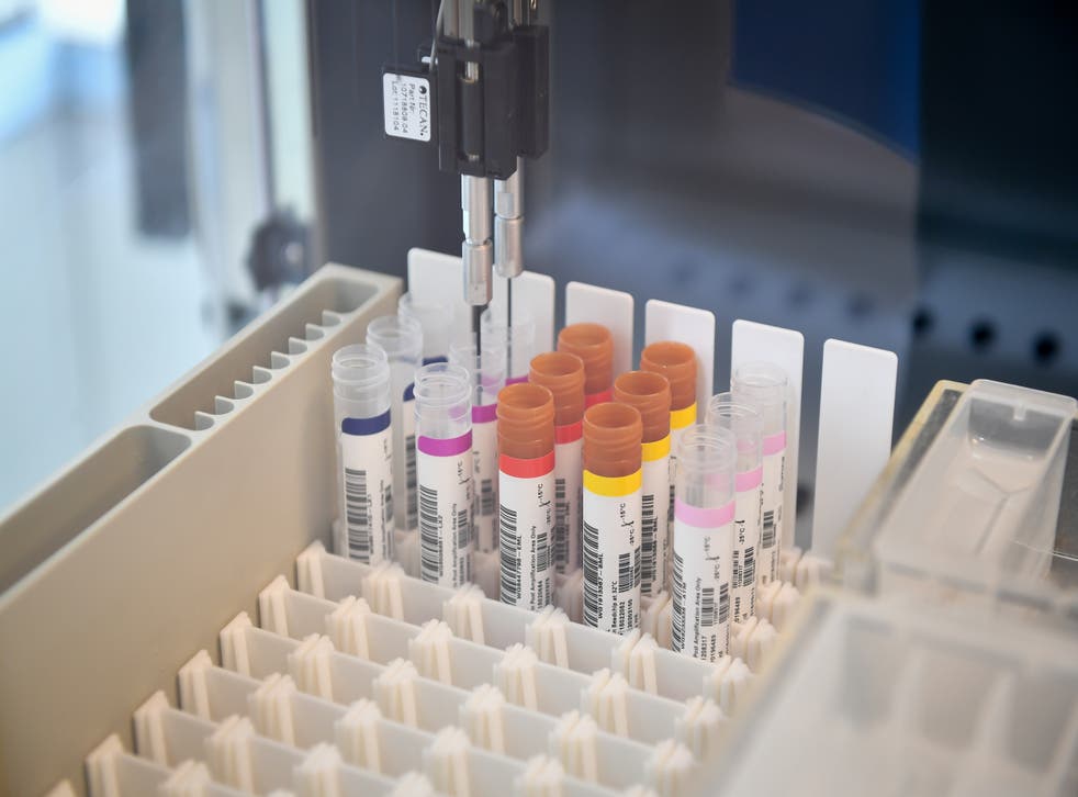 Samples are prepared for DNA extraction in a medical clinical laboratory, based at the University of Bristol (Ben Birchall/PA).