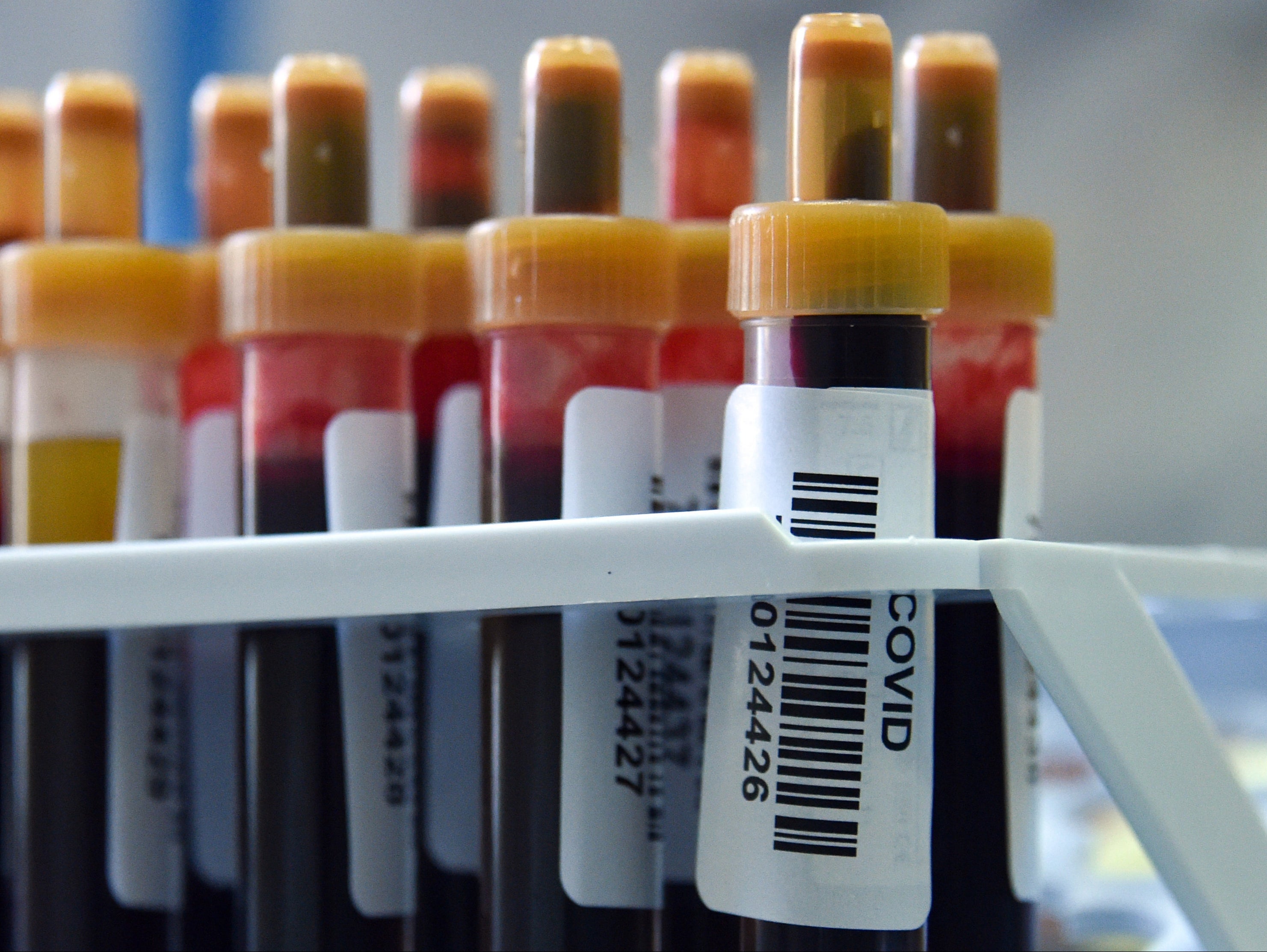 Blood samples lined up to test for Covid-19 antibodies