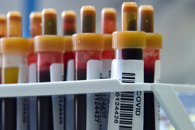 <p>Blood samples lined up to test for Covid-19 antibodies</p>