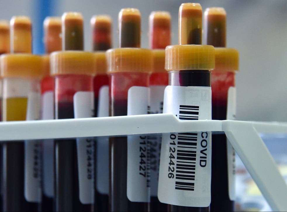 <p>Blood samples lined up to test for Covid-19 antibodies</p>