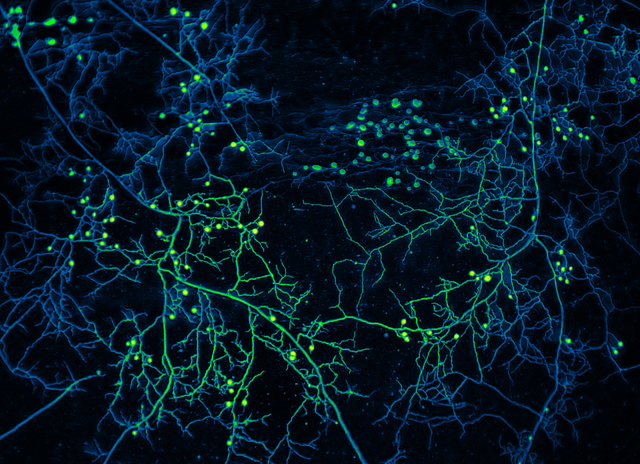 <p>A mycelium network. A new science initiative aims to protect underground fungal networks which can help tackle the climate crisis</p>