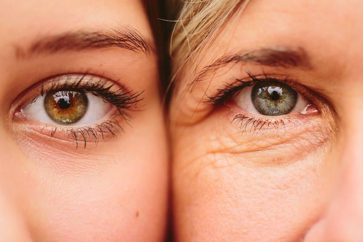 What is astigmatism? The eye condition 40 per cent of people live with