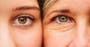 What is astigmatism? The common eye condition affecting 40% of people