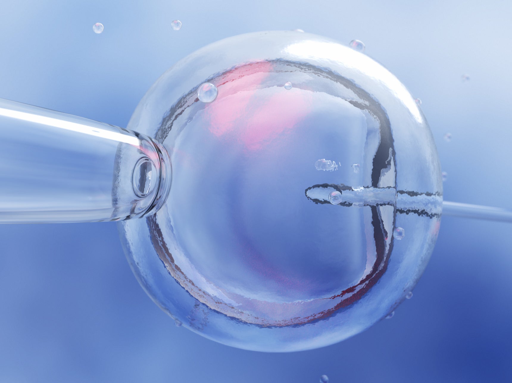IVF of a female egg through microscope