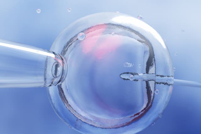 <p>IVF of a female egg through microscope</p>