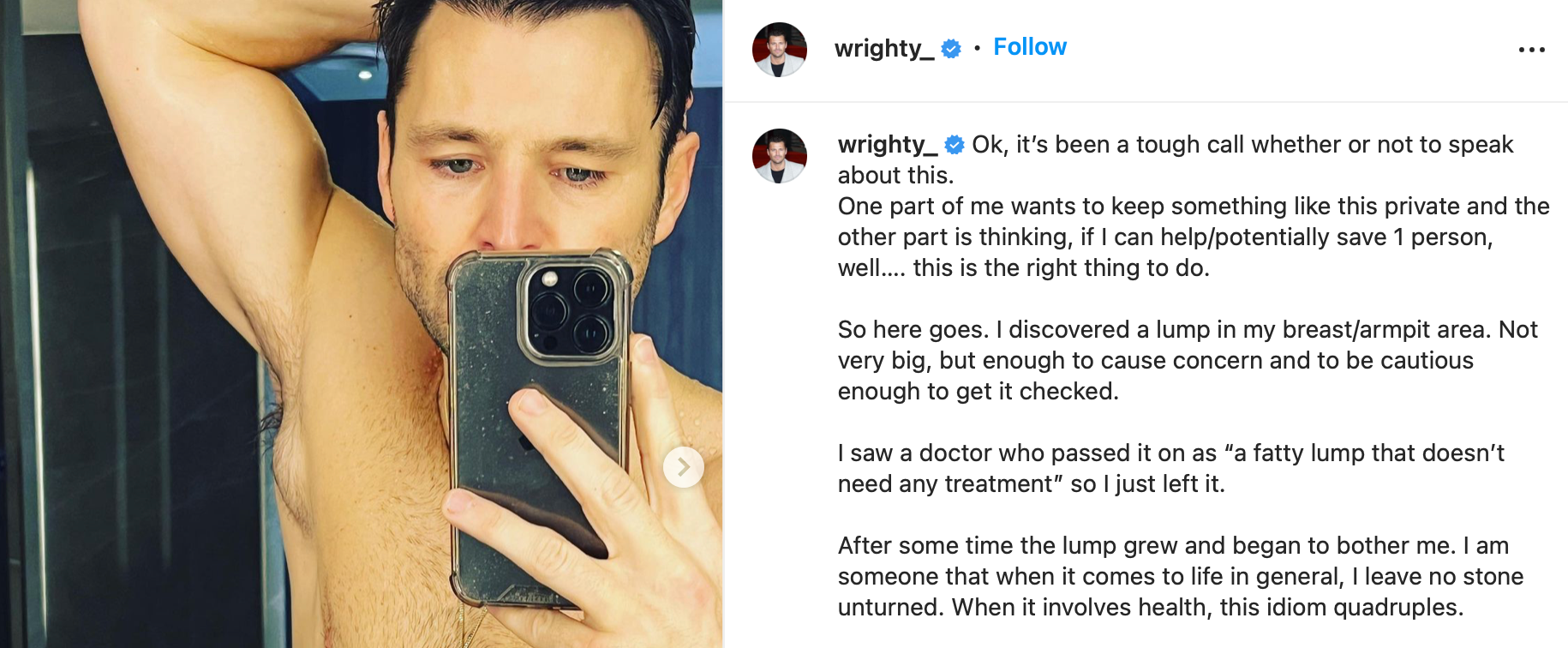 Mark Wright shared a photo of the lump he discovered