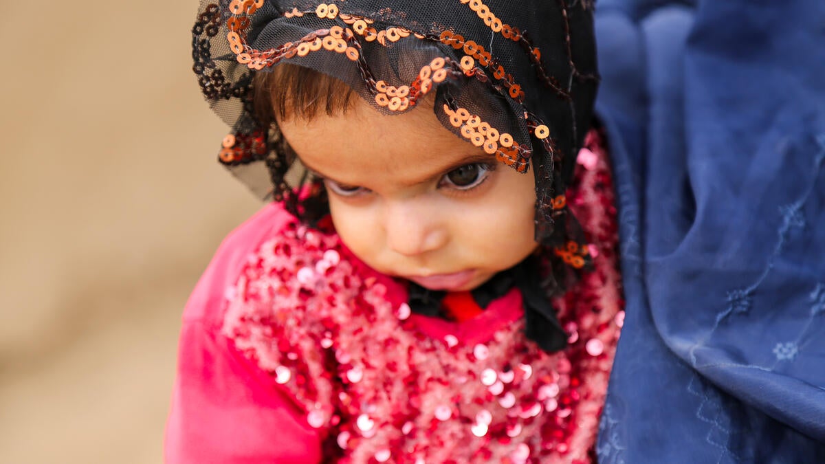 Ara, who is 18 months and is severely malnourished, being held by her mother Fatima