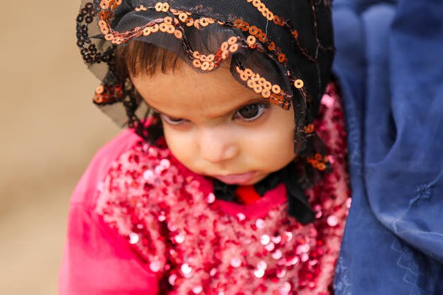 <p>Ara, who is 18 months and is severely malnourished, being held by her mother Fatima</p>