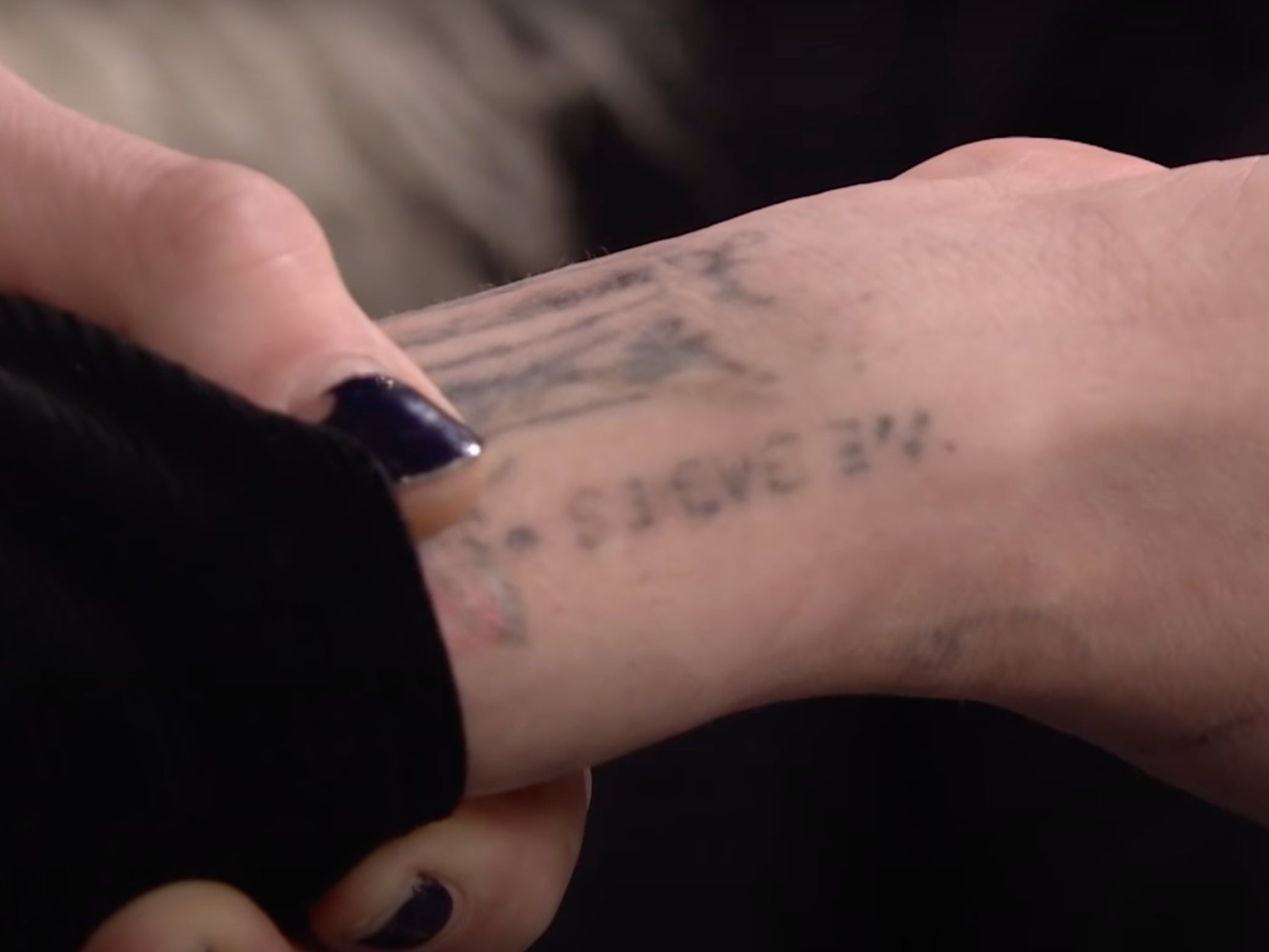 Davidson showed what was left of his tattoo after lasering it off