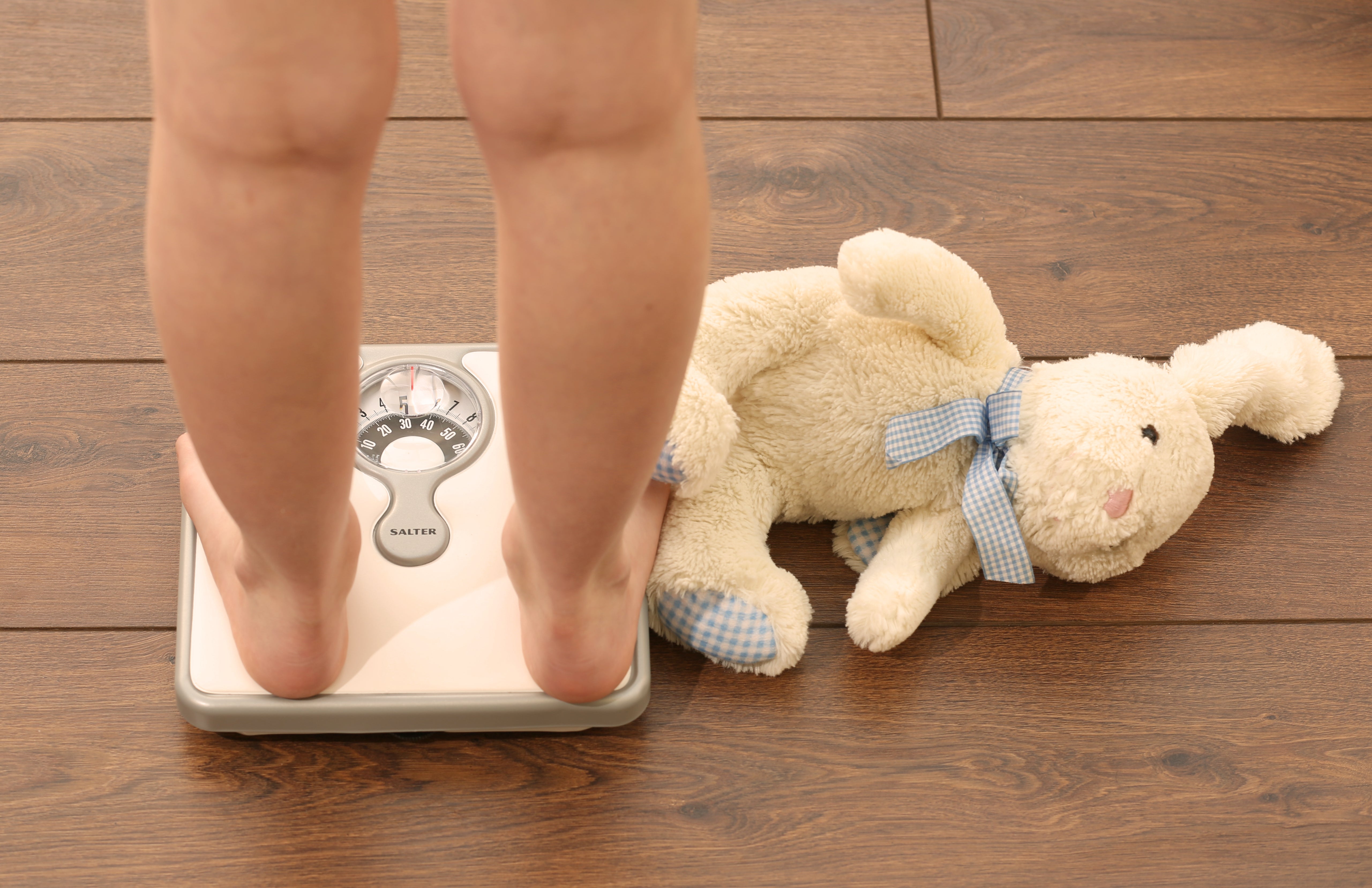 The BMA Scotland said action to tackle childhood obesity was ‘long overdue’ (Chris Radburn/PA)