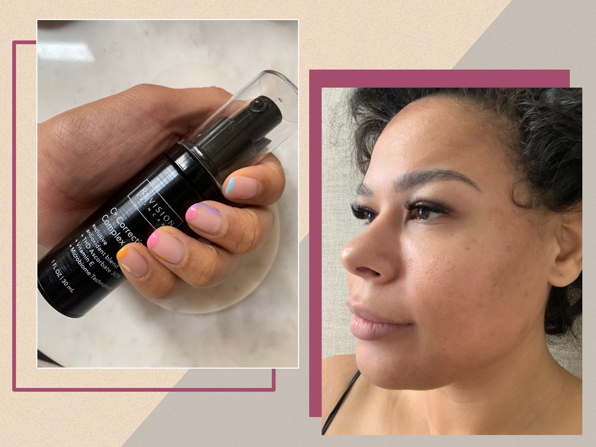 This vitamin C serum transformed my complexion – here’s why