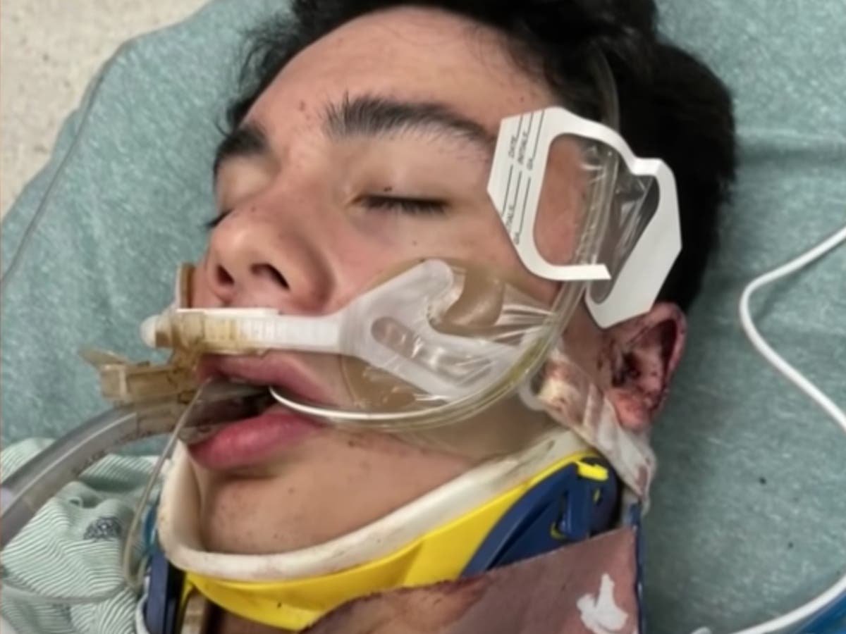 Teen football player beaten into coma in &lsquo;heinous&rsquo; ambush attack