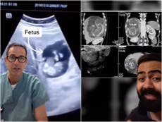 Woman’s story goes viral after baby found growing inside her liver