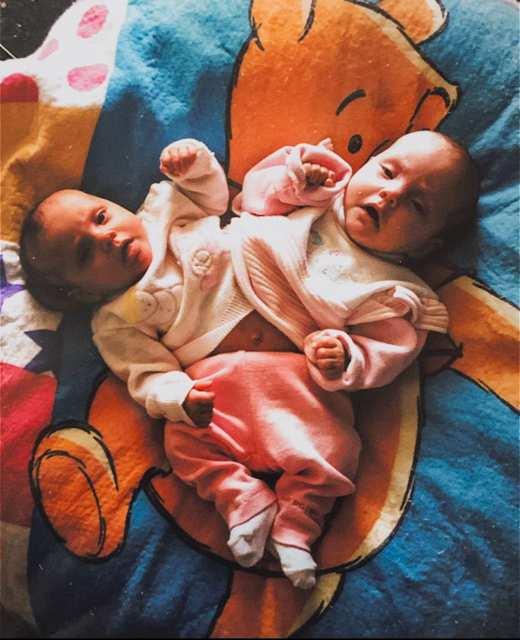Gabby and Michaela Garcia, pictured before the surgery to separate them; ‘everyone’ urged mother Karen to abort them, Ms Garcia says